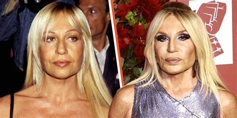 versace botox|donatella versace cosmetic surgery.